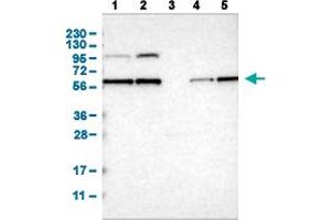 Western Blot analysis of (1) human cell line RT-4 (2) human cell line U-251MG sp (3) human plasma (IgG/HSA depleted) (4) human liver tissue, and (5) human tonsil tissue. (PPM1B anticorps  (AA 359-463))