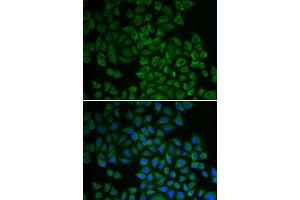 Immunofluorescence analysis of HeLa cells using SGK1 antibody.