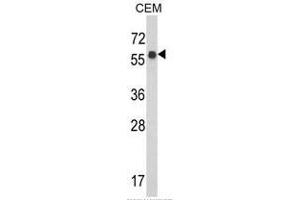 Western blot analysis of WDR1 Antibody (C-term) in CEM cell line lysates (35ug/lane). (WDR1 anticorps  (C-Term))
