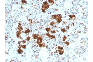 Formalin-fixed, paraffin-embedded human Pituitary stained with ACTH Monoclonal Antibody (SPM501). (POMC anticorps  (AA 25-39))
