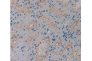 Used in DAB staining on fromalin fixed paraffin- embedded kidney tissue (CHRNA3 anticorps  (AA 32-240))