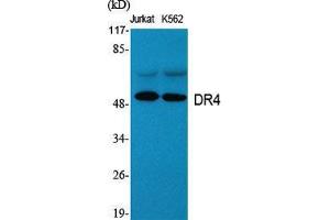 Western Blot (WB) analysis of specific cells using DR4 Polyclonal Antibody. (DR4 anticorps  (C-Term))