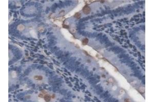 Detection of LPS in Rat Small intestine Tissue using Monoclonal Antibody to Lipopolysaccharide (LPS) (Lipopolysaccharides (LPS) anticorps)
