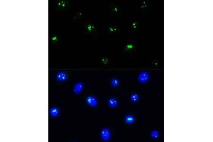 Immunofluorescence analysis of L929 cells using NOP58 Rabbit pAb (ABIN1681073, ABIN3019190, ABIN3019191 and ABIN6220753) at dilution of 1:100.