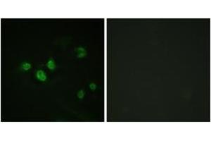 Immunofluorescence analysis of HeLa cells, using SP1 (Phospho-Thr453) Antibody.