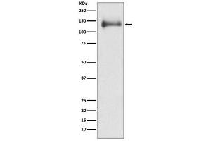 All Lanes: HDAC4 Antibody at 1/ 500 dilution.