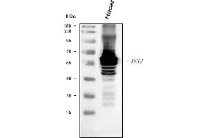 Western blot analysis of Cytokeratin 2e/KRT2 using anti-Cytokeratin 2e/KRT2 antibody (ABIN7600644).