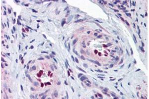 Human Uterus, Vessels (formalin-fixed, paraffin-embedded) stained with IL33 antibody ABIN343919 at 5 ug/ml followed by biotinylated goat anti-rabbit IgG secondary antibody ABIN481713, alkaline phosphatase-streptavidin and chromogen. (IL-33 anticorps  (Internal Region))