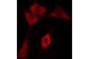 ABIN6275498 staining COLO205 cells by IF/ICC. (ARHGEF3 anticorps  (C-Term))