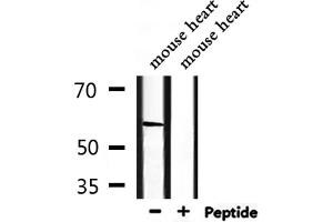 Western blot analysis of extracts from mouse heart, using PCTK2 Antibody. (CDK17 anticorps  (Internal Region))