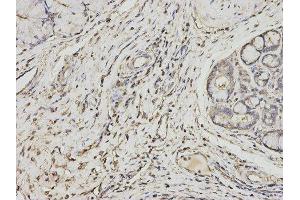 Immunohistochemistry (IHC) image for anti-Proteasome (Prosome, Macropain) Activator Subunit 1 (PA28 Alpha) (PSME1) antibody (ABIN1876546) (PSME1 anticorps)