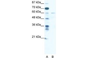 Human Jurkat; WB Suggested Anti-ZNF92 Antibody Titration: 2. (ZNF92 anticorps  (C-Term, Isoform 2))