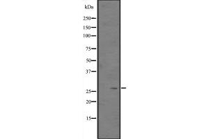 Western blot analysis of CITED2 expression in Hela cell lysate,The lane on the left is treated with the antigen-specific peptide.