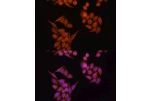 Immunofluorescence analysis of HeLa cells using OCLN antibody. (Occludin anticorps  (AA 263-522))