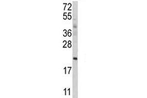 Western blot analysis of ATG12 antibody and MCF-7 lysate.