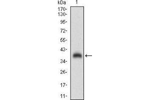 Western blot analysis using SHC1 mAb against human SHC1 (AA: 385-495) recombinant protein.