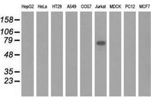 Western blot analysis of extracts (35 µg) from 9 different cell lines by using anti-KLHL2 monoclonal antibody. (KLHL2 anticorps  (AA 1-100, AA 494-593))
