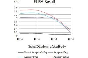 Black line: Control Antigen (100 ng),Purple line: Antigen (10 ng), Blue line: Antigen (50 ng), Red line:Antigen (100 ng)