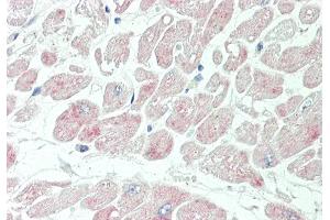 Rabbit Anti-KCNIP2 antibody  Formalin Fixed Paraffin Embedded Tissue: Human Heart Primary antibody Concentration: 1:100 Secondary Antibody: Donkey anti-Rabbit-Cy3 Secondary Antibody Concentration: 1:200 Magnification: 20x Exposure Time: 0.