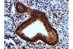 Image no. 9 for anti-EPM2A (Laforin) Interacting Protein 1 (EPM2AIP1) antibody (ABIN1498045) (EPM2AIP1 anticorps)