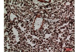Immunohistochemistry (IHC) analysis of paraffin-embedded Mouse Lung, antibody was diluted at 1:100.