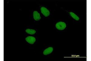 Immunofluorescence of purified MaxPab antibody to ZNF43 on HeLa cell. (ZNF43 anticorps  (AA 1-803))