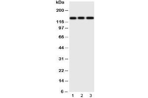 Western blot testing of ERBB4 antibody and Lane 1:  human HeLa;  2: (h) U87;  3: mouse Neuro-2a cell lysate. (ERBB4 anticorps  (N-Term))