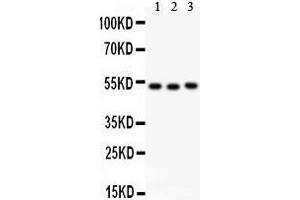 Anti- Factor VII antibody, Western blotting All lanes: Anti Factor VII  at 0. (Factor VII anticorps  (C-Term))