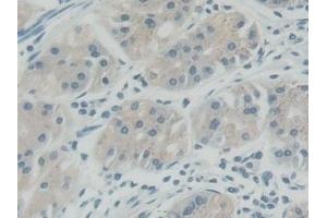 Detection of ROR2 in Human Stomach Tissue using Polyclonal Antibody to Receptor Tyrosine Kinase Like Orphan Receptor 2 (ROR2) (ROR2 anticorps  (AA 683-934))