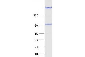 Validation with Western Blot
