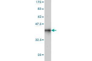Western Blot detection against Immunogen (37.