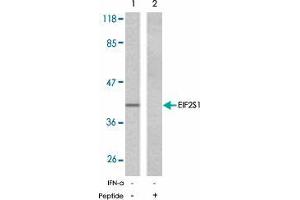 Western blot analysis of extracts from A-431 cells, untreated or EGF-treated (200 ng/ml, 5 min), using EIF2S1 polyclonal antibody  . (EIF2S1 anticorps)