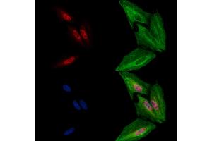ABIN6263316 and ABIN6278007 staining  cells by IF/ICC.