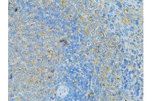 Immunohistochemistry of paraffin-embedded rat slpeen using TLR4 antibody (ABIN5975781) at dilution of 1/100 (40x lens). (TLR4 anticorps)