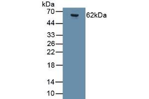 Detection of Recombinant GRIA2, Human using Monoclonal Antibody to Glutamate Receptor, Ionotropic, AMPA 2 (GRIA2) (GRIA2 anticorps  (AA 413-527))