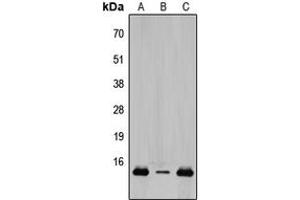 Western blot analysis of TCEAL8 expression in HeLa (A), Raw264.