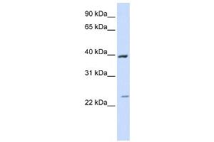 Western Blotting (WB) image for anti-Acyl-CoA Dehydrogenase, Long Chain (ACADL) antibody (ABIN2458052) (ACADL anticorps)