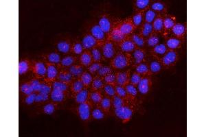 IF analysis of Gephyrin/GPHN using anti-Gephyrin/GPHN antibody (ABIN7600086). (Gephyrin anticorps  (AA 148-736))