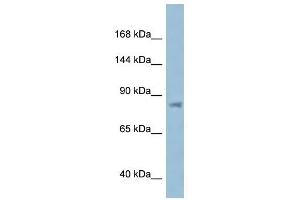 Western Blot showing KPNB1 antibody used at a concentration of 1 ug/ml against ACHN Cell Lysate (KPNB1 anticorps  (N-Term))