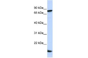 WB Suggested Anti-ZNF281 Antibody Titration:  0. (ZNF281 anticorps  (Middle Region))