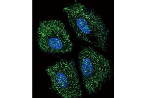 Confocal immunofluorescent analysis of UGT2B15 Antibody (Center) (ABIN656309 and ABIN2845611) with NCI- cell followed by Alexa Fluor 488-conjugated goat anti-rabbit lgG (green).