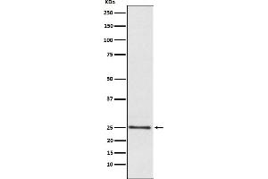 Western blot analysis of Lysophospholipase 1 expression in Human fetal liver lysate.