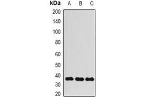 Western blot analysis of ALKBH3 expression in HepG2 (A), Hela (B), MCF7 (C) whole cell lysates. (ALKBH3 anticorps)
