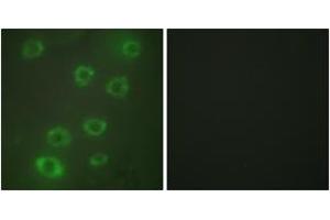 Immunofluorescence (IF) image for anti-Pentraxin 3 (PTX3) (AA 1-50) antibody (ABIN2889436) (PTX3 anticorps  (AA 1-50))