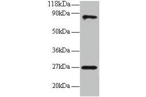 Western blot All lanes: RPL17 antibody at 2 μg/mL + EC109 whole cell lysate Secondary Goat polyclonal to rabbit IgG at 1/15000 dilution Predicted band size: 22, 18, 27 kDa Observed band size: 27, 80 kDa (RPL17 anticorps  (AA 2-184))
