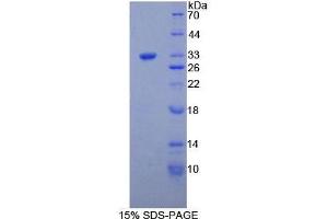 SDS-PAGE analysis of Mouse COL1a1 Protein.