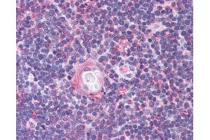 Anti-CDC25B antibody IHC of human thymus. (CDC25B anticorps  (AA 56-105))