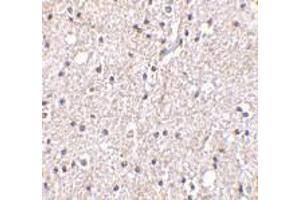 Immunohistochemistry of BRSK2 in human brain tissue with BRSK2 antibody at 5 μg/ml. (BRSK2 anticorps  (C-Term))