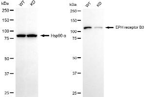 Western blotting analysis using EPH receptor B3 antibody (ABIN7798456). (Recombinant EPH Receptor B3 anticorps)