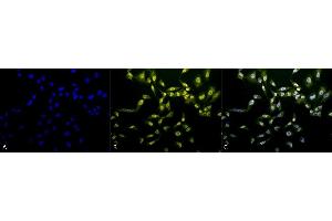 Immunocytochemistry/Immunofluorescence analysis using Rabbit Anti-Phosphothreonine Polyclonal Antibody (ABIN361757). (Phosphothreonine anticorps)